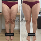 Leggings 3D VivaCuerpo™ - Negro